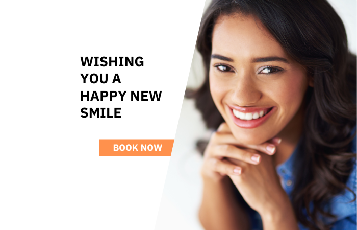 Benefits of Veneers