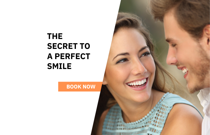 Veneers in Tyers