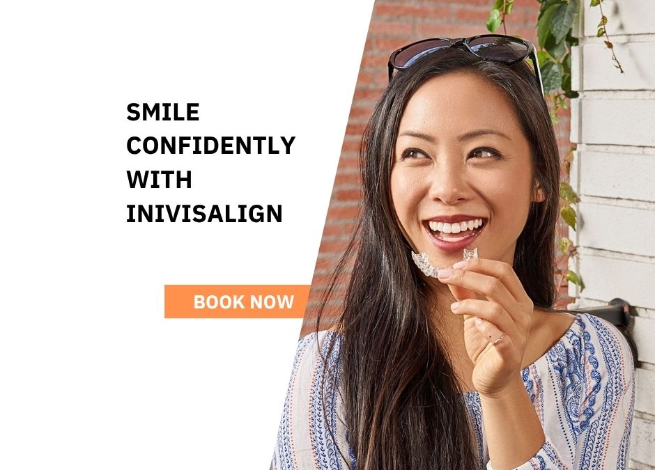 Invisalign vs veneers