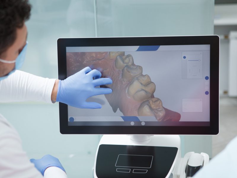 Dentist examining dental scan of a patient on the computer screen