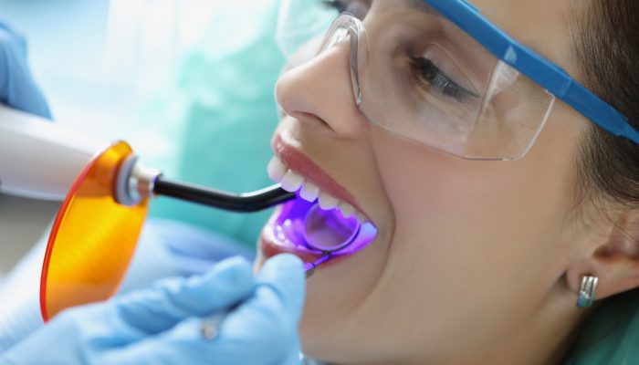 Portrait of female client on appointment in stomatology cabinet getting whitening procedure. Dentist provide full teeth care for patient. Health concept