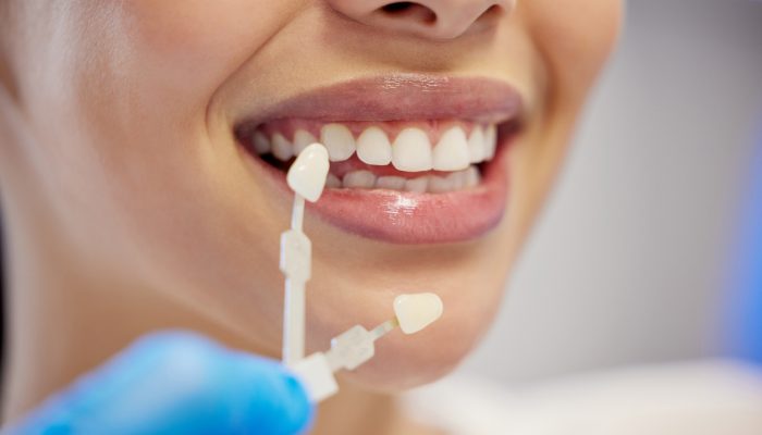 Where dentistry meets artistry