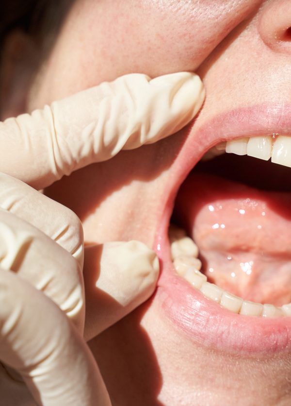 Female dentist examining open mouth with gloved hands highlighting healthy teeth and gums in close-up view.