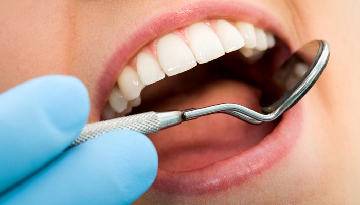 Close-up of female with open mouth during oral checkup at the dentist's  Note to inspector: the image is pre-Sept 1 2009