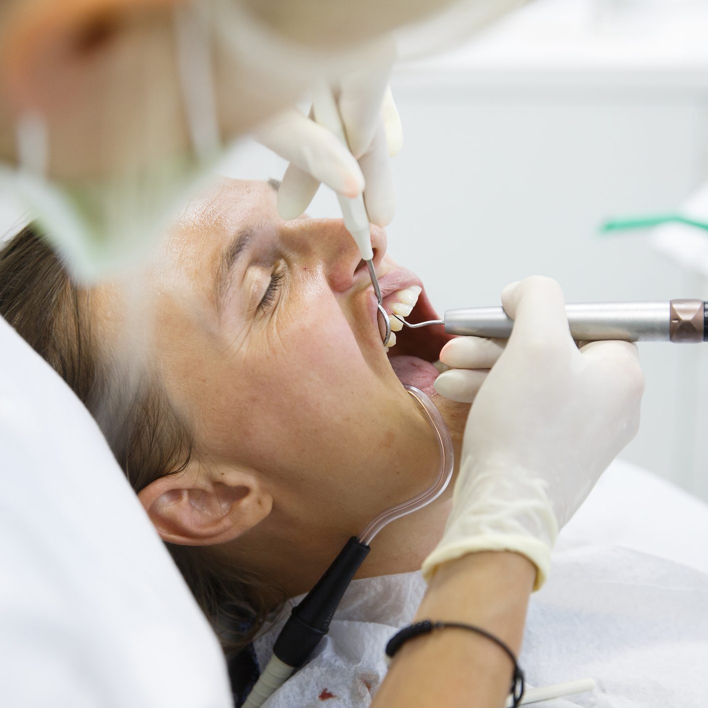 Woman getting her gum pocket depth measured with periodontal probe, held by dental hygienist, examining progression of periodontal disease. Dental hygiene, periodontal disease, prevention concept.