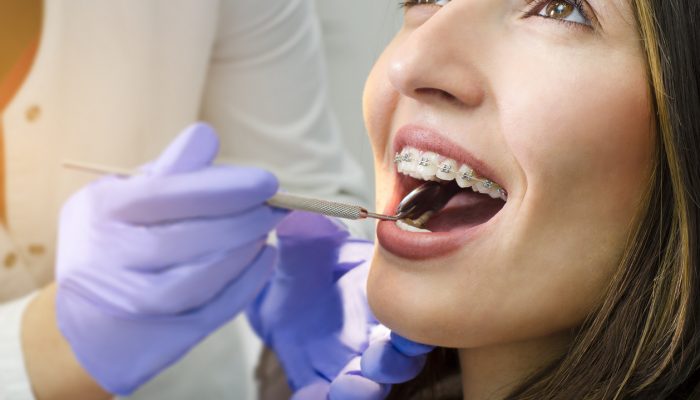 Closeup of beautiful girl with dental braces check up, satisfied smiling, while doctor looking her teeth