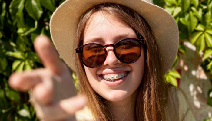 veneers-vs-braces